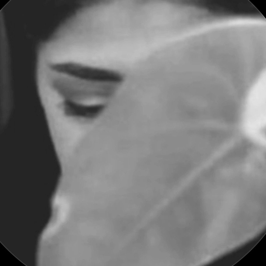 Asma